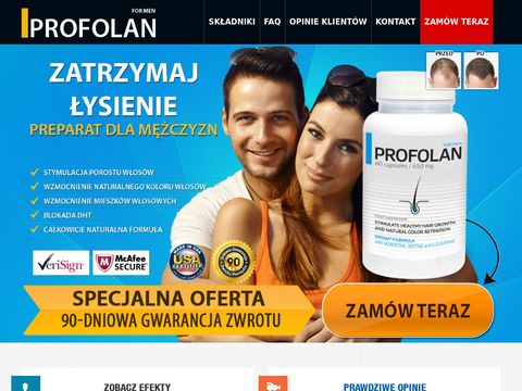 Profolan.pl - tabletki na łysienie